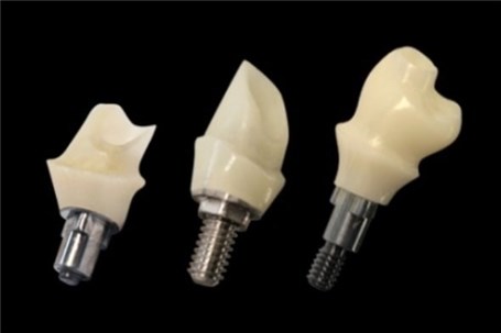 ایمپلنت دندانی تولید می شود